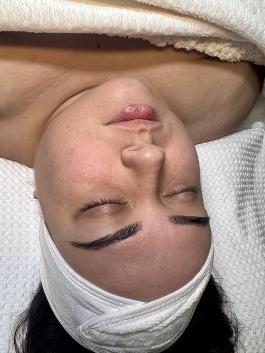 Before treatment
